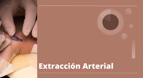 Extracción Arterial... ¿Si o no?