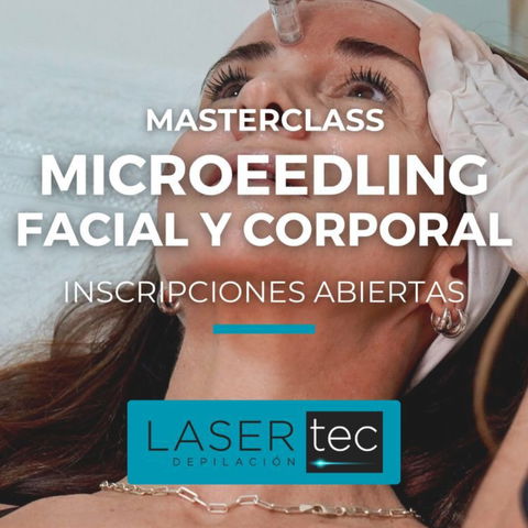 Microneedling facial y corporal 