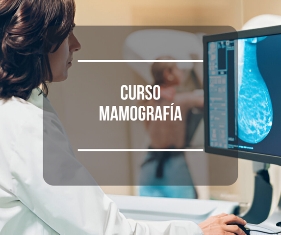 Mamografía - Segunda Edición