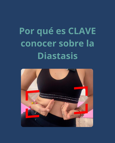 Comprender los abdominales: ¿tengo diastasis?
