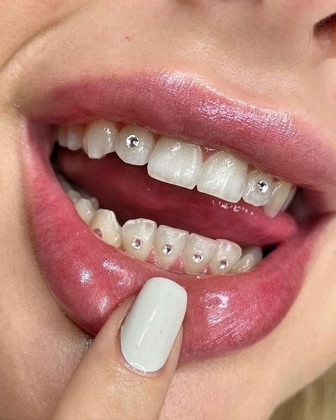 Joyeria Dental 