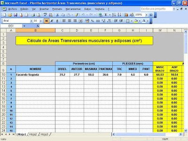 Cálculo de Áreas Transversales musculares y adiposas (cm²)