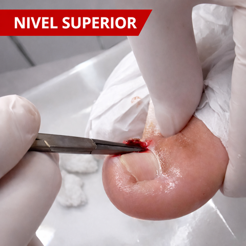 Patologias de las Uñas - PRESENCIAL