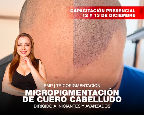 Micropigmentación de Cuero Cabelludo - Scalp Presencial 12 y 13 de Diciembre