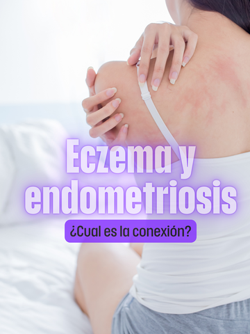 Eczema y endometriosis ¿cuál es la conexión?