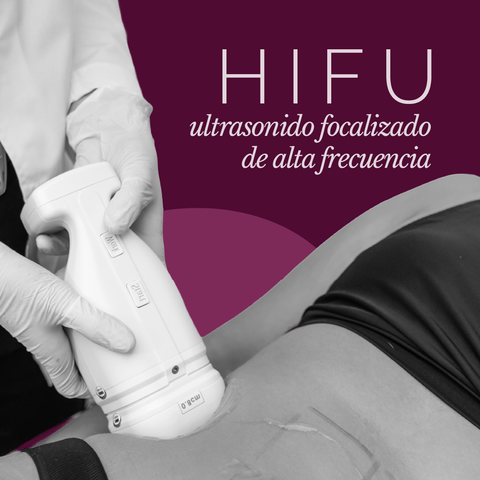 HIFU: Tensado cutáneo no invasivo 