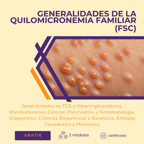Generalidades de la Quilomicronemia Familiar (FCS)