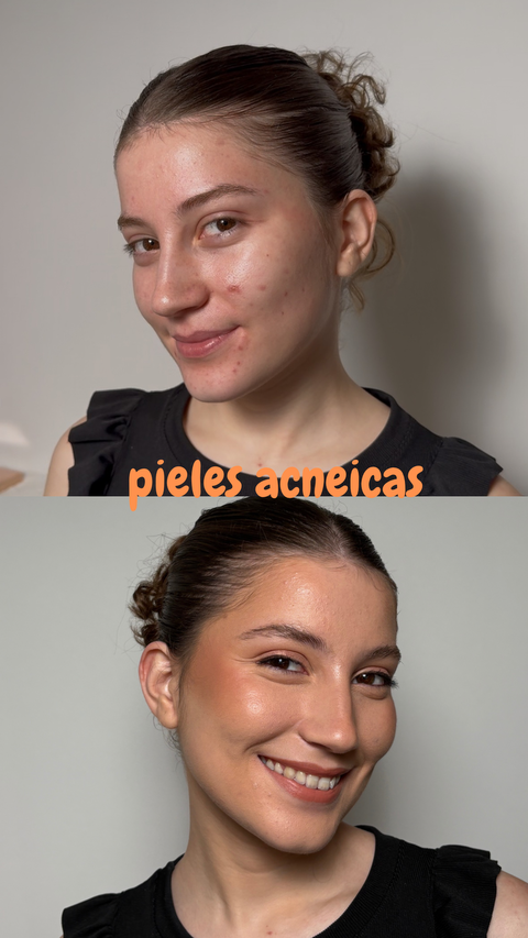 Maquillaje para pieles acneicas 
