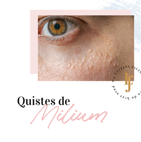 Quistes de Milium