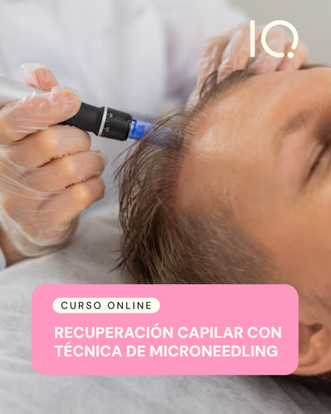 Recuperación Capilar con técnica de Microneedling