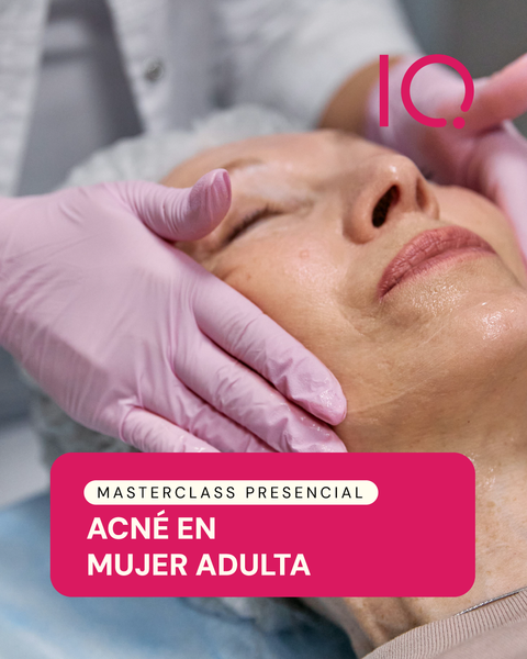 Masterclass: Acné en mujer adulta