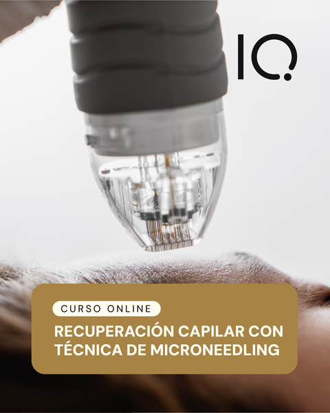 Recuperación Capilar con técnica de Microneedling