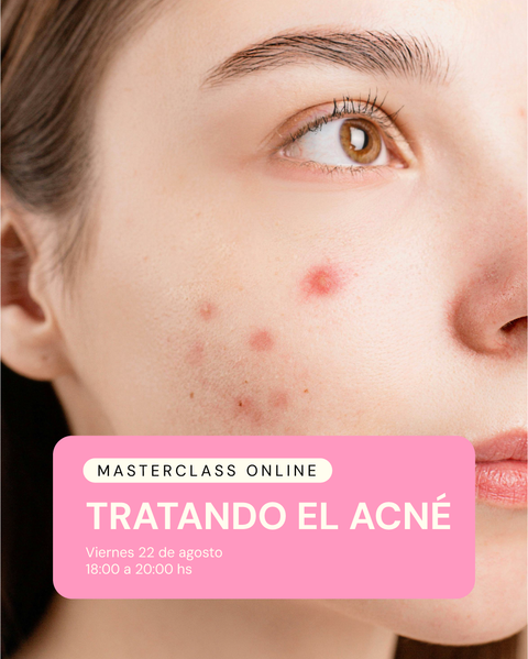 Máster Class online: Tratando el Acné