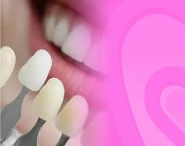 Blanqueamiento Dental