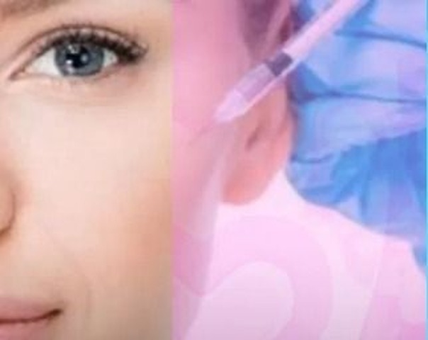Mesoterapia