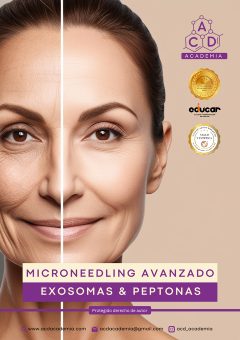 Certificación Internacional en Microneedling 