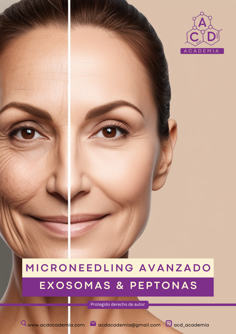 Curso Profesional de Microneedling.