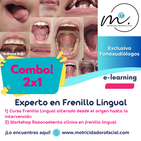 Experto en Frenillo lingual
