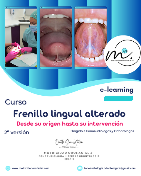 2ª VERSIÓN - Curso Frenillo lingual alterado: desde su origen hasta su intervención
