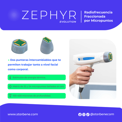 Capacitación Zephyr Evolution