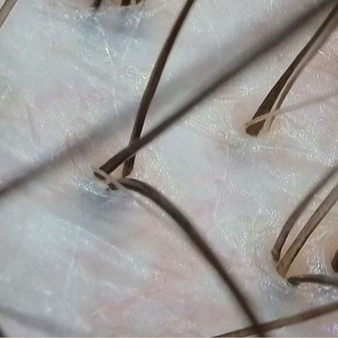 Detox dermocapilar: por qué lavar el cabello no es suficiente