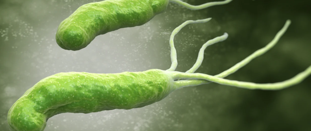Helicobacter pylori: otra mirada