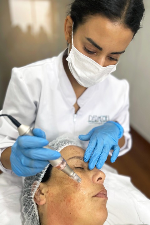 Taller Dermapen Profesional