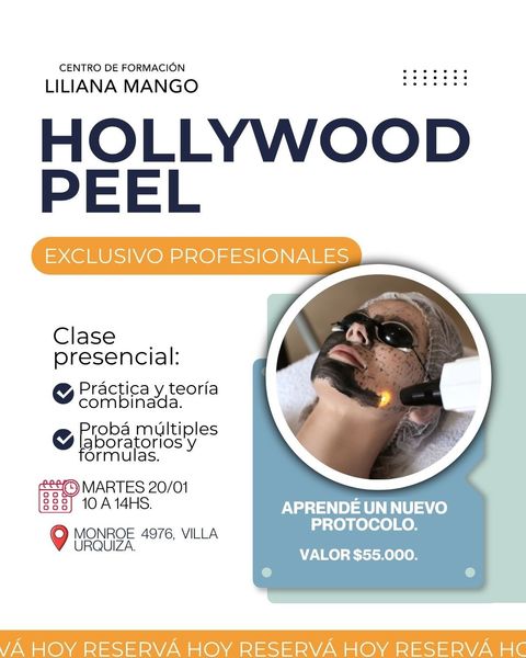 Hollywood peel 