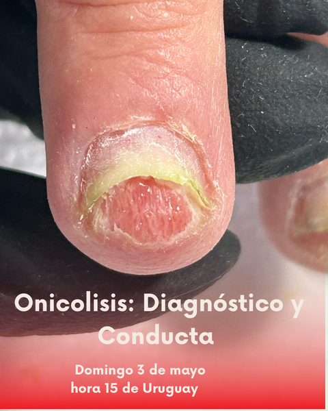 ONICOLISIS Diagnóstico y conducta profesional .