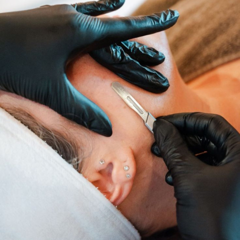 Limpieza con dermaplaning
