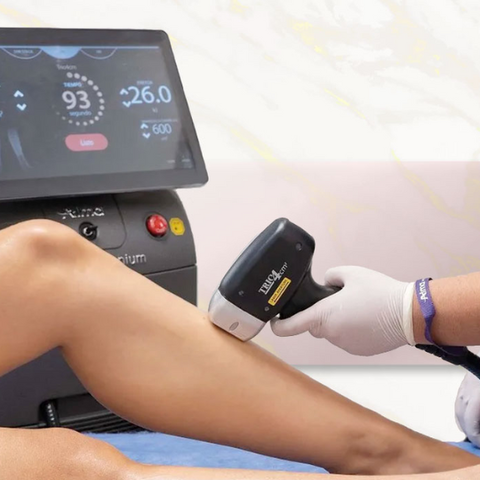 Depilación láser – Cuerpo completo