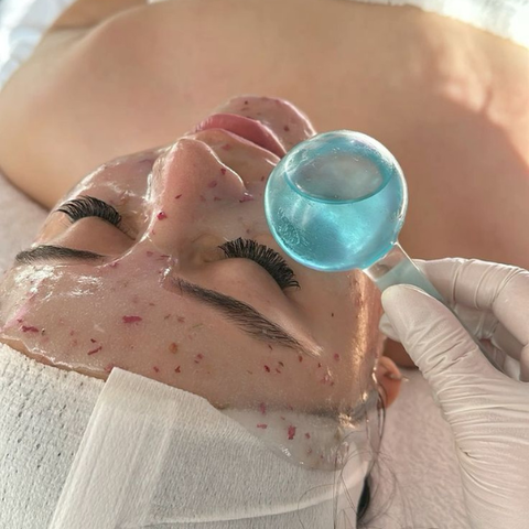 Peeling Químico Facial o Corporal
