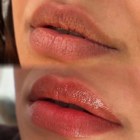 Revitalización labial