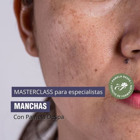 Masterclass para especialistas en manchas