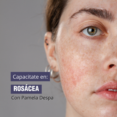 Masterclass Tratamiento para la Rosácea