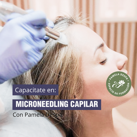 Workshop Microneedling Capilar
