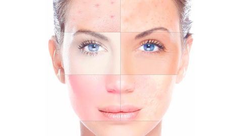 Te ayudo a identificar tu tipo de piel