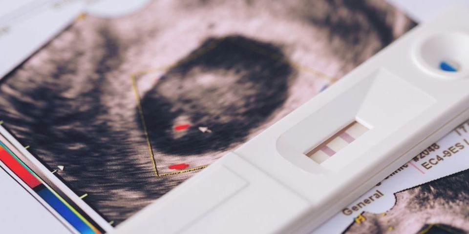 Órbita | Preconcepción