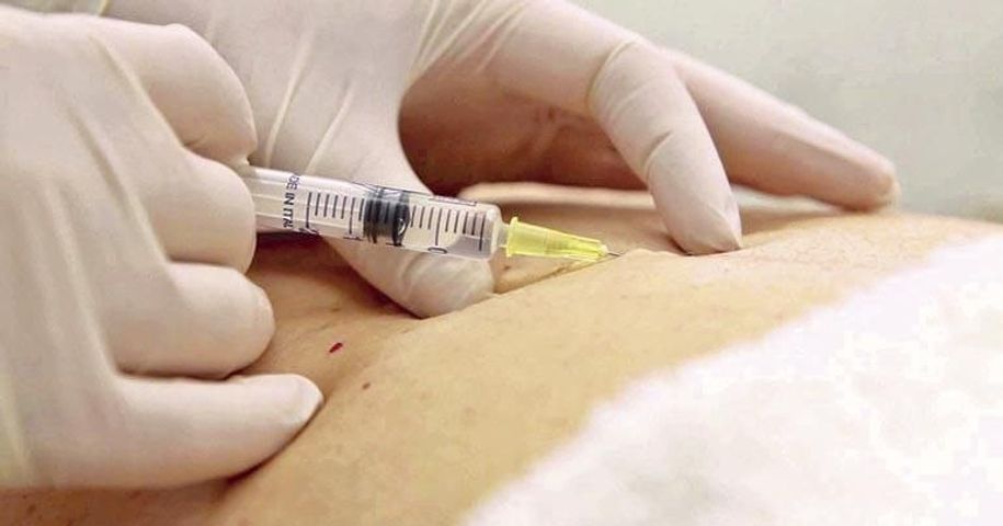 Plasma rico en plaquetas -tratamiento del dolor 