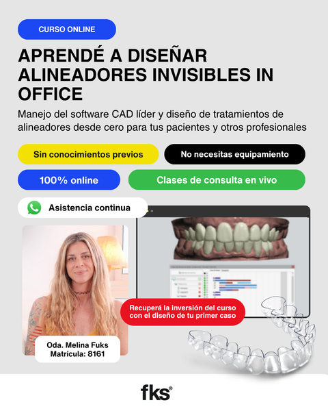 Diseño de Alineadores Invisibles