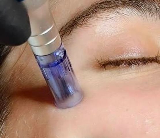 Exosomas faciales